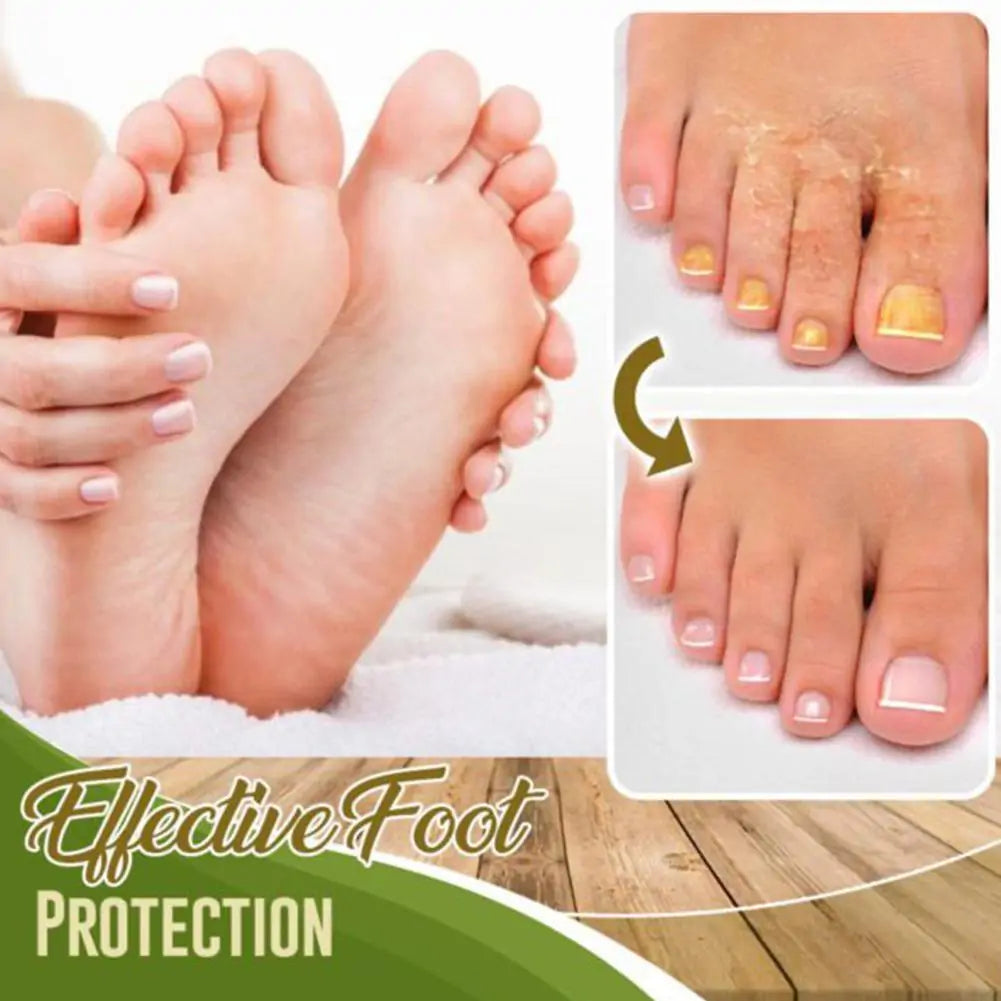 Anti-Fungal Feet Spray