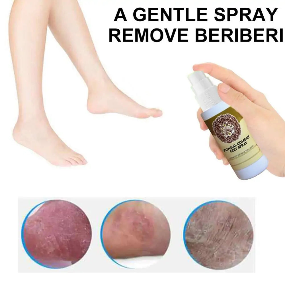 Anti-Fungal Feet Spray