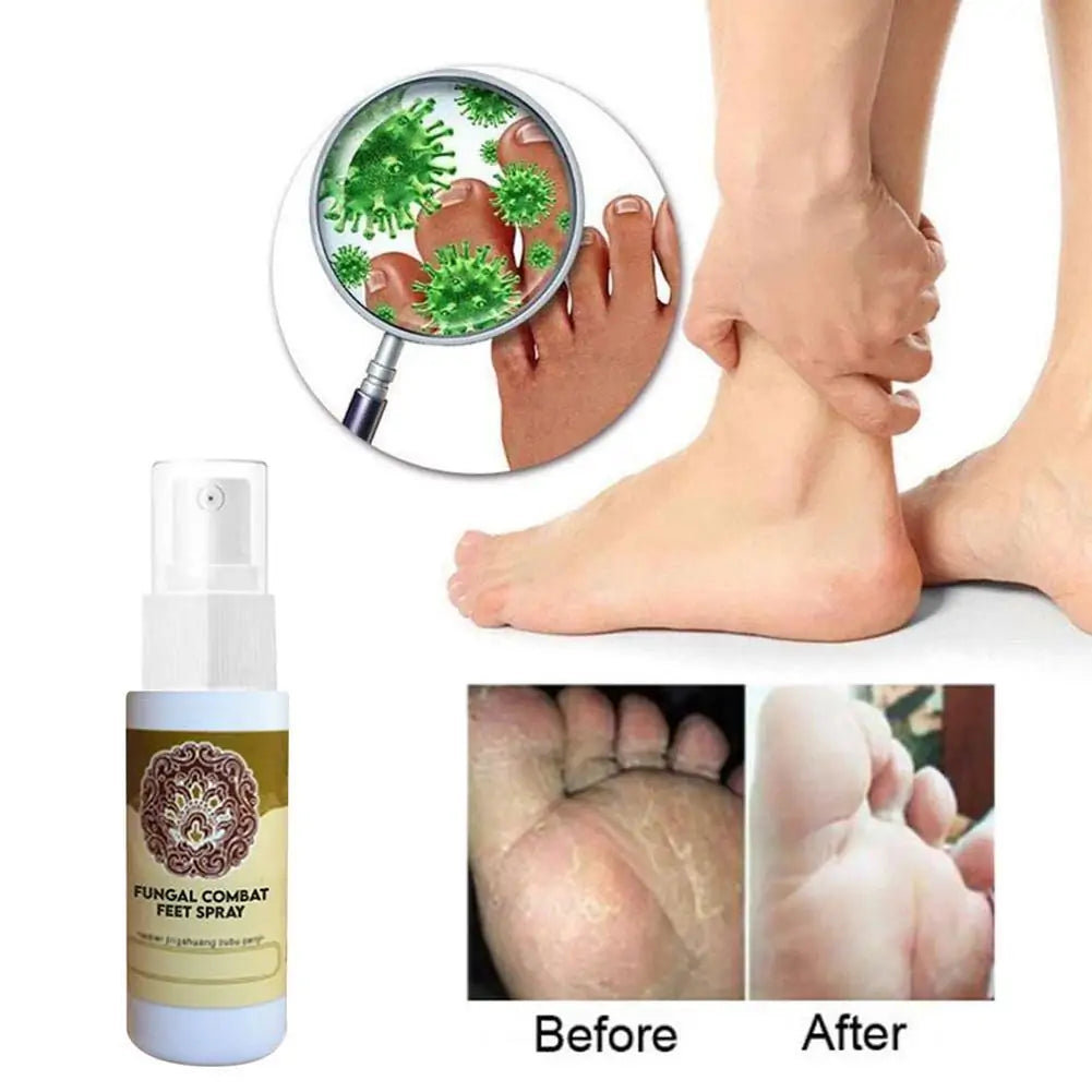 Anti-Fungal Feet Spray